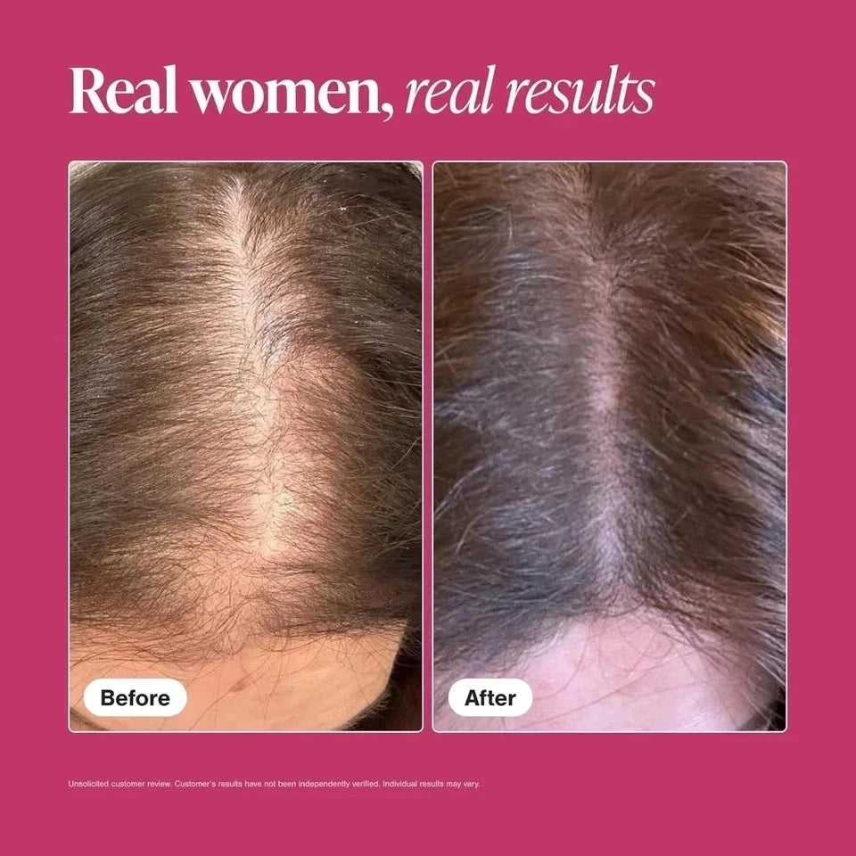 Viviscal Maximum Hair Growth Supplements for Women For Thicker Hair - 180 Tablet
